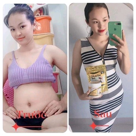 Combo giảm mỡ bụng giảm cân Mị Hương